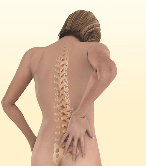 r&uuml;cken (Foto: Patientenakademie)