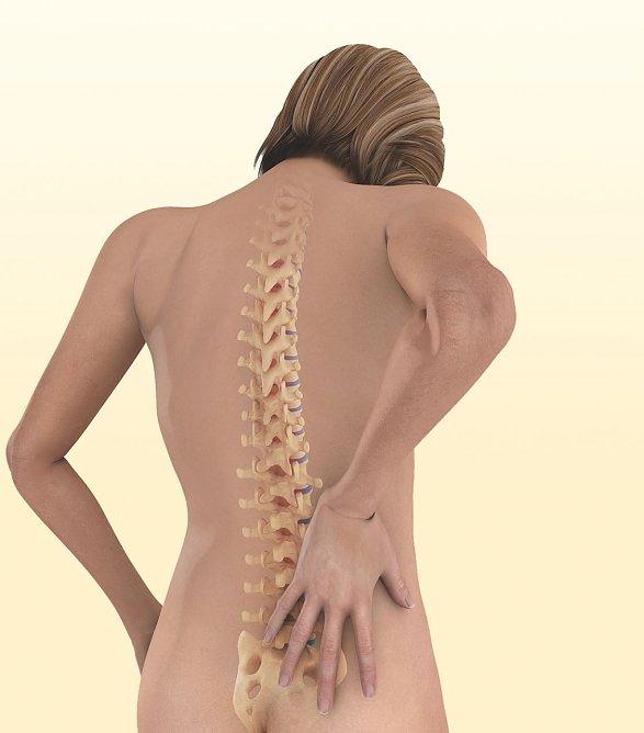 r&uuml;cken (Foto: Patientenakademie)